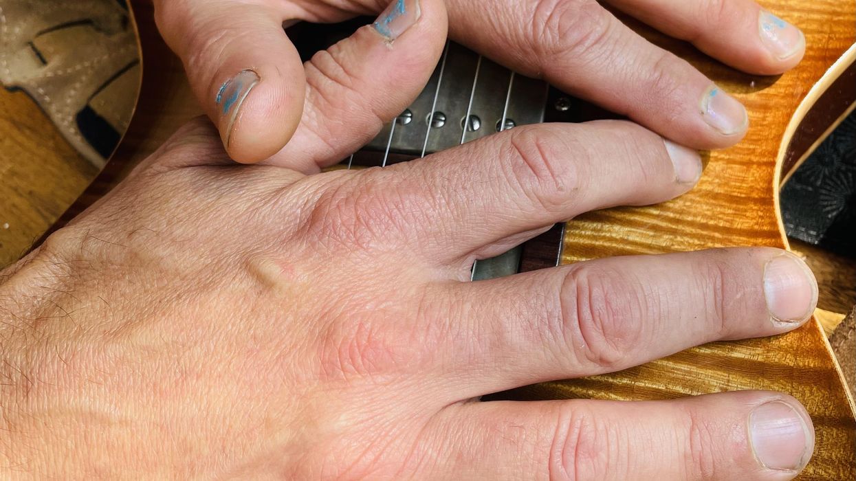 Last Call: My Aching Back