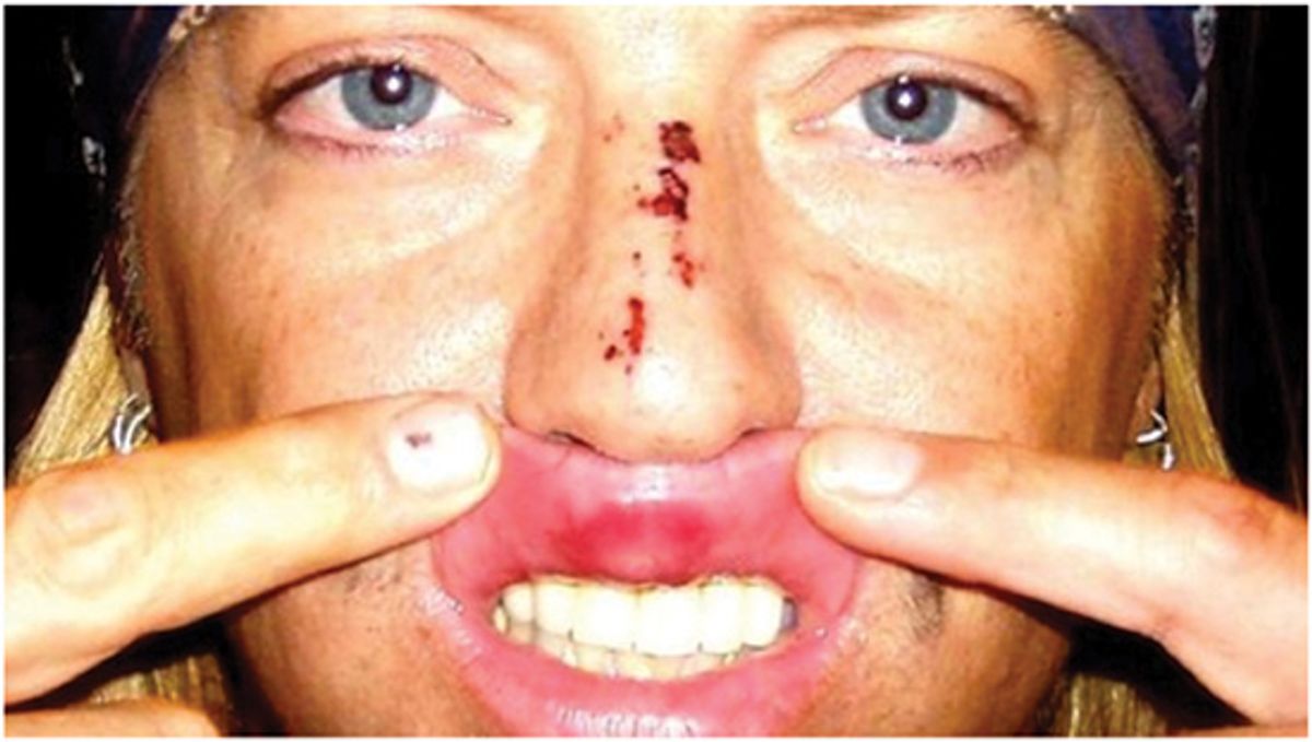 Rock ’n’ Roll Is a Contact Sport